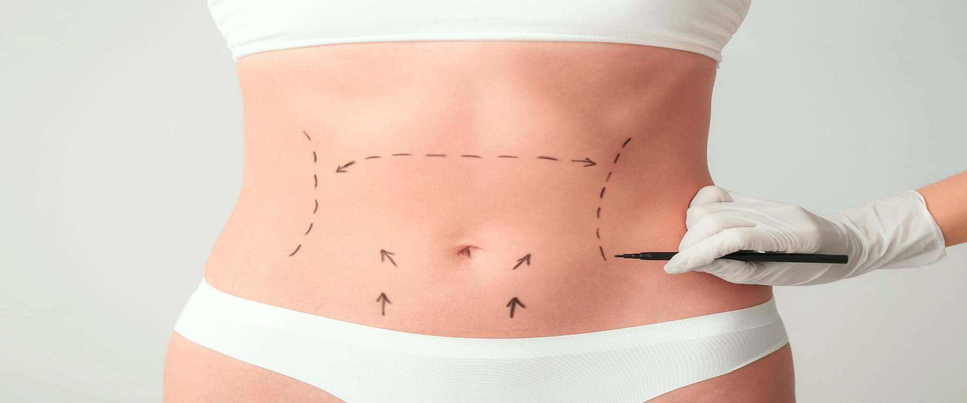 La Abdominoplastia OXIN Travel